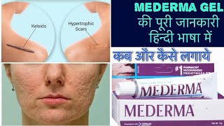 Mederma cream का इस्तेमाल कैसे करना चाहिए हिन्दी सरल भाषा में जानकारी