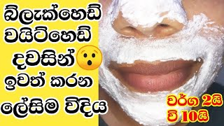 කලු ලප කැලැල් ඉවත් කරන මැජික් එක blackheads whiteheads remover#blackheads#whiteheads#skincare