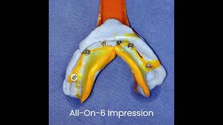 #All-On-6 implant placement @kosmodentalacademy #shorts