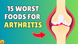 15 Most Dangerous Foods For Arthritis That You Often Overlook | VisitJoy