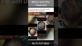 Before and After treatment || skin and hair treatment photos || Dr.Arif Iqbal