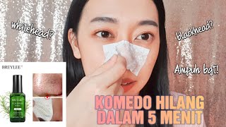 BREYLEE BLACKHEAD MASK BENERAN AMPUH ANGKAT KOMEDO MEMBANDEL! (HONEST REVIEW)