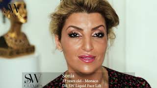 DRSW Liquid Vampire Facelift™ Patient Testimonial - Sonia | Dr Sherif Wakil