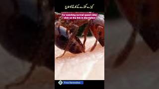 keeda katne par kya karen|insect bite cure| Free Ramedies