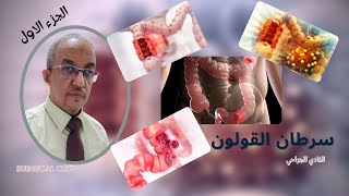 سرطان القولون| الجزء الاول | أعراض سرطان القولون