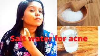 How to use salt for acne  | diy face cleanser and toner | The Dreamy Girl Anju