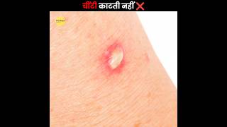 इसलिए चिटियों🐜 के काटने पर इतना दर्द होता है 😰 | How an Ant Bite | The Fact | #shorts #ytshorts