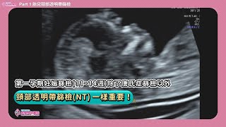 宏其婦幼醫院_第一孕期除了唐氏症 頸部透明帶篩檢一樣很重要 EP1