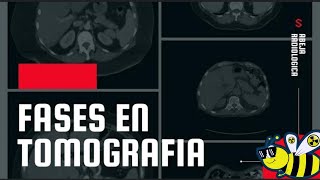 🔴⚫Fases en tomografía, las conoces todas? las sabes identificar y su utilidad?🔴⚫