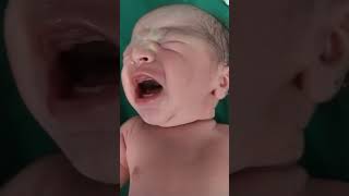 new born baby imediate after birth #subcribe for more vedios#