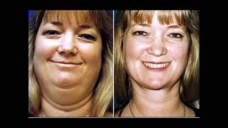 ░▒▓ A Miracle Weight Loss - Lose 2 Kilos In 5 Days - Miracle Weight Loss Drink