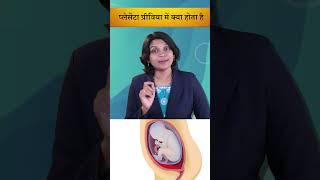 प्लेसेंटा प्रीविया में क्या होता है#pregnancy#sanjivangarbhsanskar