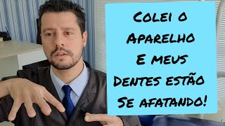 Colei aparelho e meus dentes estão separando! É normal?