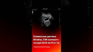 Визуализация желчного пузыря датчиками Mindray SC8-1s и SC6-1s #shorts #short #tiktok #reels #узи