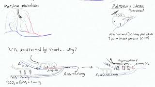 Shunt 2 - Why is PaCO2 Unaffected by Shunt?