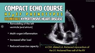 〖Echocardiography〗 Clinical phenotypes of HFpEF - hypertensive heart disease 🫀