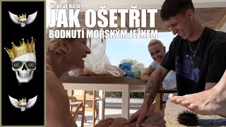 Jak ošetřit bodnutí mořským ježkem? | How to treat a sea urchin awakening? | Greek indigenous recipe