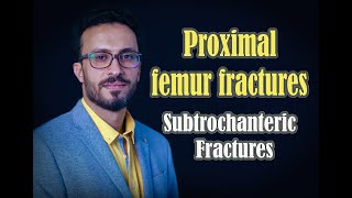 08 Proximal femur: Subtrochanteric fractures