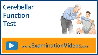 Cerebellar Function Tests