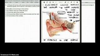 N12 B3 Q12 : COCHLEAR IMPLANT