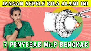 Beberapa Penyebab Mr.P Bengkak dan Cara Mengatasinya || dr. Andi