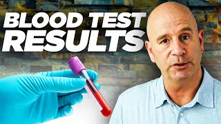 Understanding Your Blood Test Results: A Complete Guide (Part 1)