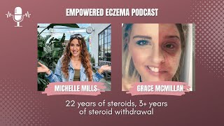 Podcast | Skinderella, 22 Years of Using Steroids Resulted In...