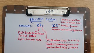 Brugada syndrome with mnemonic in less than 2 minutes