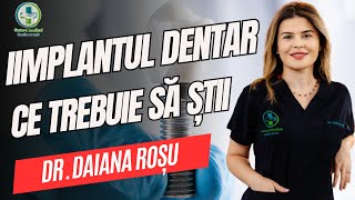 Implantul dentar. Ce presupune?