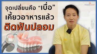 จุดเปลี่ยนคือ "เบื่อ" เคี้ยวอาหารแล้ว...ติดฟันปลอม | คนไข้รากฟันเทียม เคสคุณหมอธนากร Dentalimage