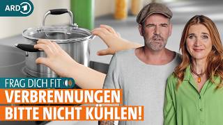 Verbrennungen: Hausmittel, Erste Hilfe und wann zum Arzt? | Frag dich fit mit Doc Esser und Anne