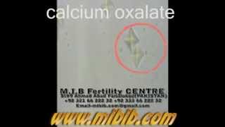 Calcium oxalate video