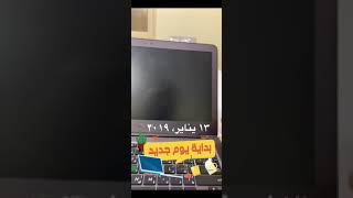 مشاكل زيادة الزيت في المحرك