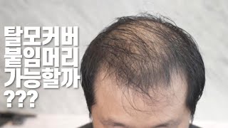 울산에서 증모술하러 6년째 오고 계십니다 (탈모붙임머리, 블랭크유, 헤어증모술)