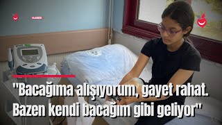 13 Yaşındaki Depremzede Verde, Çocuk İyilik Merkezi Aracılığıyla Bacak Protezine Kavuştu