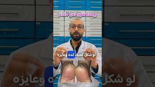 وصفة سحرية لتنعيم كعب القدم  #shorts