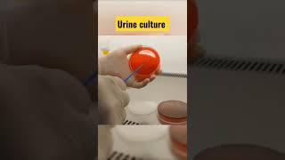 urine culture #shorts