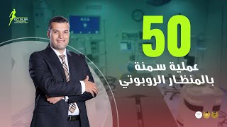 50 عملية سمنة باستخدام المنظار الروبوتي مع ضياء سرحان