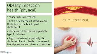 Obesity and Somatotypes GCSE PE