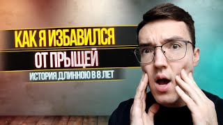 КАК Я ИЗБАВИЛСЯ ОТ ПРЫЩЕЙ? ИСТОРИЯ ДЛИННОЮ В 8 ЛЕТ.