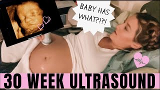 30 WEEK ULTRASOUND | Lake's REACTION to seeing baby for the first time + VALENTINES DAY VLOG