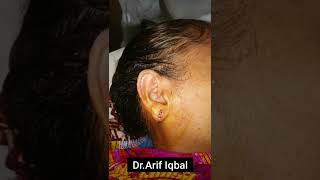 Earlobe Repair Surgery By Dr.Arif Iqbal