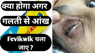 अगर आँख में Fevikwik चली जाए तो क्या होगा ? क्या आंख चिपक जाएगी? by Ark Mystery #shorts #arkmystery