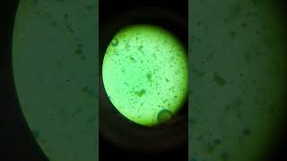 Calcium oxalate in urine sample #urineinfection #urine #biology