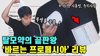 부작용 없는 바르는 프로페시아! 의사가 직접 사용해보고 느낀 솔직후기 (feat. 가격, 사용법, 주의사항)