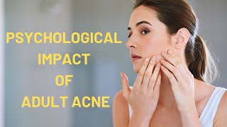 Psychological Impact of Acne In Adults