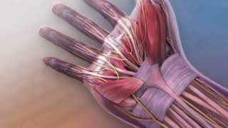 Karpal Tünel Sendrom ! Carpal tunnel syndrome Animation