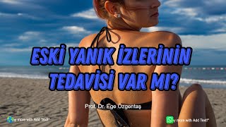 Eski Yanık İzlerinin Tedavisi Var mı?