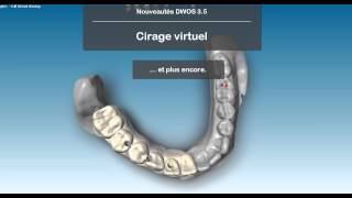 DWOS 3.5 en français