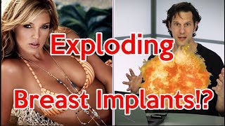 Exploding Breast Implants?